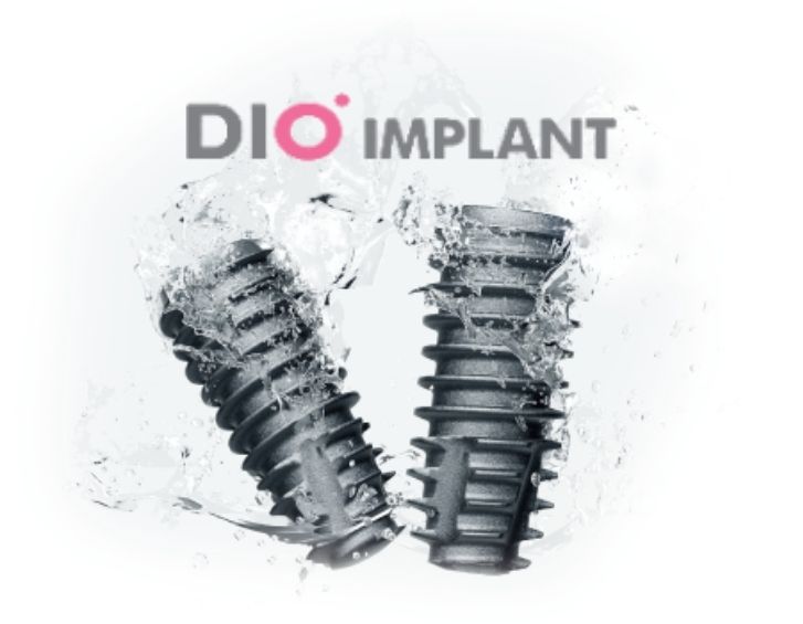 DIO implant|四ツ谷の歯医者・歯科　プラム四谷歯科クリニック