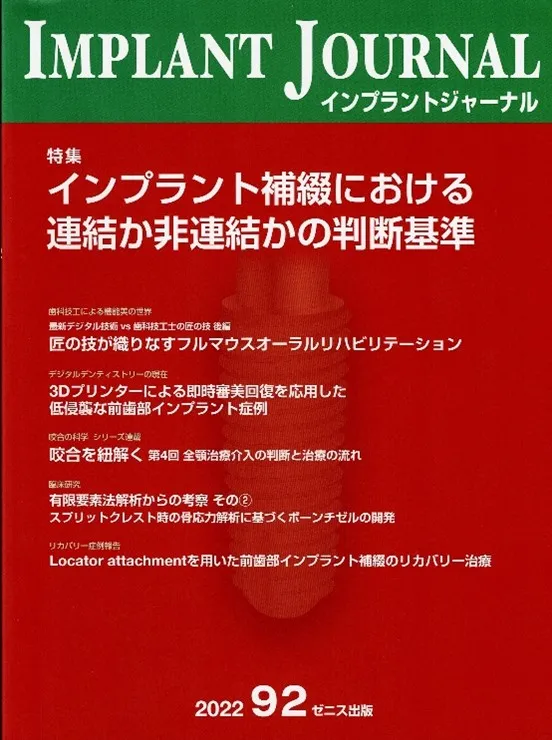 3Dプリンターによる即時審美回復を応用した低侵襲な前歯部インプラント症例