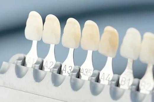 事前のクリーニングとシェードテイキング（色調の選定）